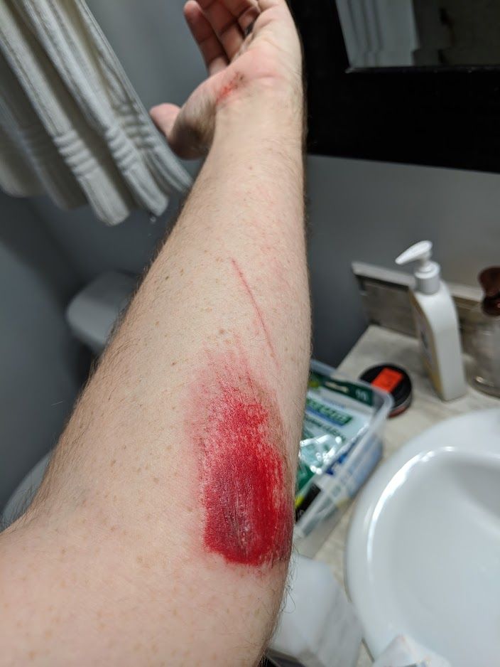 hurt